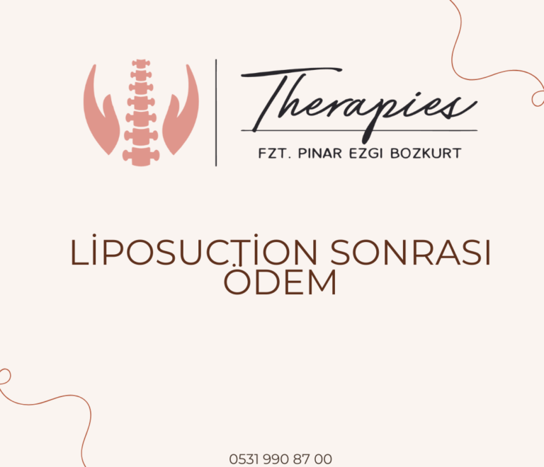 Liposuction Sonrası Ödem