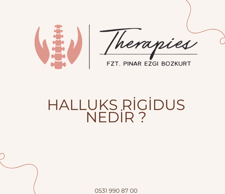 Halluks Rigidus Nedir ?