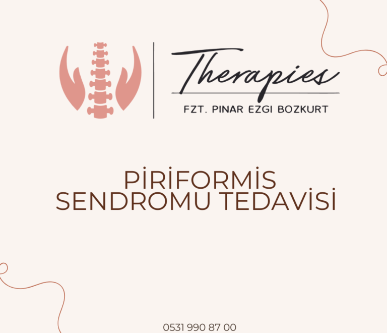 Piriformis Sendromu Tedavisi